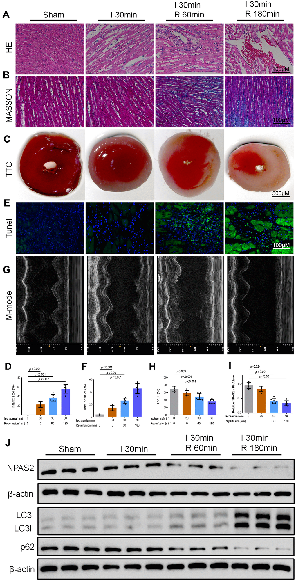 NPAS2 was downregulated in myocardial ischaemia/reperfusion injury rats. (A, B) Typical images of H&E and Masson staining of myocardial tissue segments. (C, D) Typical images of TTC of myocardial tissue segments. The infarct size was measured and calculated as a percentage of the total area. (E, F) Typical images of Tunel of myocardial tissue segments. The relative percentages of apoptotic cells were calculated. (G, H) Typical echocardiographic images of M-mode and LVEF. (I) The mRNA level of NPAS2 in rat myocardial tissue was determined by qRT-PCR. (J) The protein level of NPAS2 (90kDa), LC3B (14 and 16kDa) and p62 (62kDa) in rat myocardial tissue was determined using Western Blot. Data are expressed as mean ± SEM (n = 6).