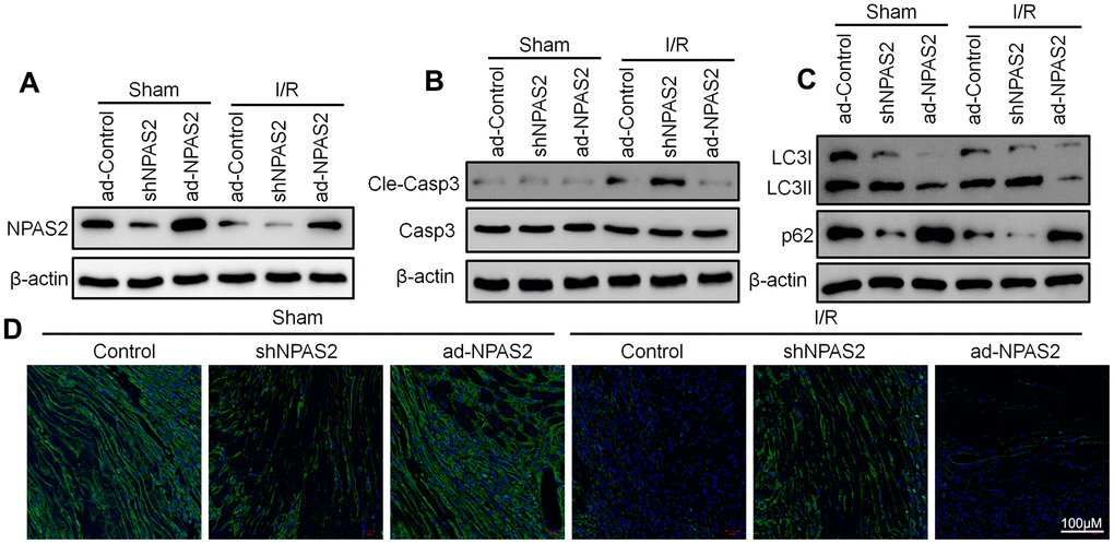 Overexpression of NPAS2 inhibited autophagy in ischaemia/reperfusion injury rats. (A) The protein level of NPAS2 in rat myocardial tissue was determined using Western Blot. (B) The protein level of Cleaved-Caspase-3 (17kDa) and Caspase-3 17kDa) in rat myocardial tissue was determined by Western Blot. (C) The protein level of LC3B and p62 in rat myocardial tissue was determined using Western Blot. (D) Representative photomicrographs of LC3B (green) immunofluorescence in rat myocardial tissue. DAPI was used to counterstain nuclei.