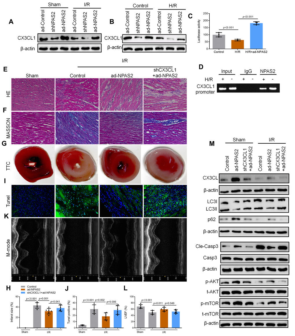 NPAS2 transcriptionally promoted CX3CL1 expression in vivo. (A) The protein level of CX3CL1 (100kDa) in rat myocardial tissue was determined by Western Blot. (B) The protein level of CX3CL1 (100kDa) in H9c2 cells was determined by Western Blot. (C) H9c2 cells were transfected with CX3CL1 promoter and the luciferase activity was determined after 24 hours. (D) Amplification of the CX3CL1 promoter sequence was performed BY ChIP assay in H9c2 cells. (E, F) Typical images of H&E and Masson staining of myocardial tissue segments. (G, H) Typical images of TTC of myocardial tissue segments. The infarct size was measured and calculated as a percentage of the total area. (I, J) Typical images of Tunnel of myocardial tissue segments. The relative percentages of apoptotic cells were calculated. (K, L) Typical echocardiographic images of M-mode and LVEF. (M) The protein level of CX3CL1 (100kDa), LC3B (14 and 16kDa), p62 (62kDa), Cleaved-Caspase-3 (17kDa), Caspase-3 (17kDa), p-AKT (60kDa), t-AKT (60kDa), p-mTOR (289kDa) and t-mTOR (289kDa) in rat myocardial tissue was determined by Western Blot. Data are expressed as mean ± SEM (n = 6).