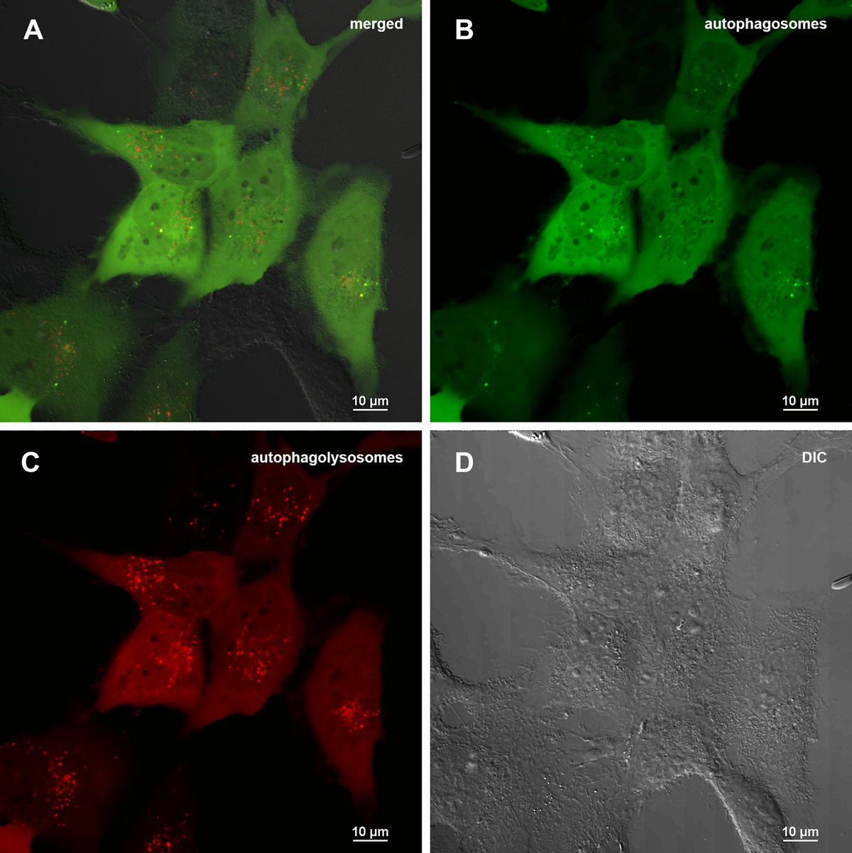 Assessment of autophagy in MRC5-SV40 cells carrying GFP-LC3-mCherry reporter (control sample) when treated with DMSO 0.5% after 24 hours. (A) merge of red, green fluorescence channels and bright field, (B) green fluorescence channel, (C) red fluorescence channel, (D) bright field.