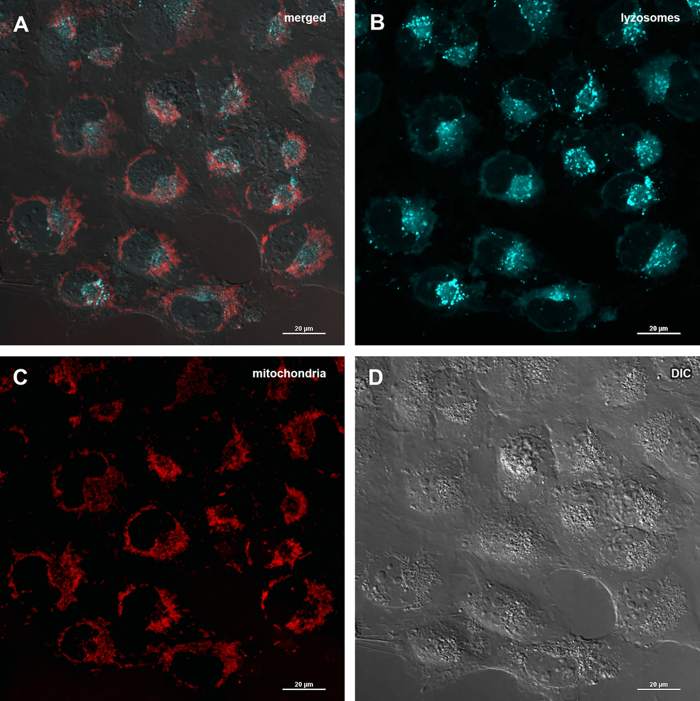 Assessment of mitophagy in MRC5-SV40 cells when treated with Abisil at concentration of 50 μg/ml for 24 hours. (A) merge of red, green fluorescence channels and bright field, (B) green fluorescence channel, (C) red fluorescence channel, (D) bright field.