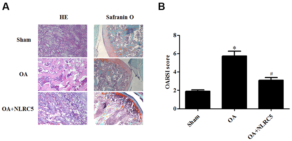 NLRC5 treatment ameliorated cartilage degeneration in an OA model in rats. (A) HE and Safranin O staining in each group (100×). (B) OARSI scores of each group to assess cartilage degeneration. *p p 