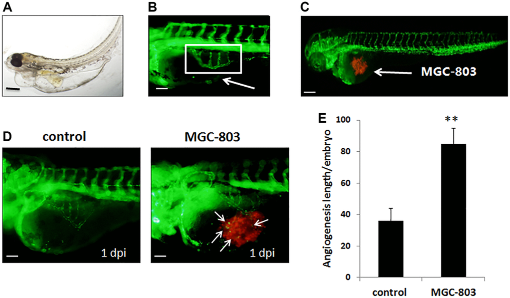 Gastric cancer cell MGC-803 promoted angiogenesis in transgenic zebrafish tg (fli1a-EGFP). (A) Biologic morphology of zebrafish. Scale bar: 200 μm. (B) Fluorescence image of subintestinal vessels of the uninjected embryo. Scale bar: 50 μm. (C) Gastric cancer cell lines were injected to the zebrafish embryo, MGC-803 was taken as an example in the figure. Scale bar: 200 μm. (D) MGC-803 cells promoted angiogenesis at 1 dpi compared with control group. The white arrow indicated the tumor cell induced angiogenesis, dpi: days post injection. Scale bar: 50 μm. (E) Quantitative analysis of the length of newly formed vessels in zebrafish with/without inducing by MGC-803.