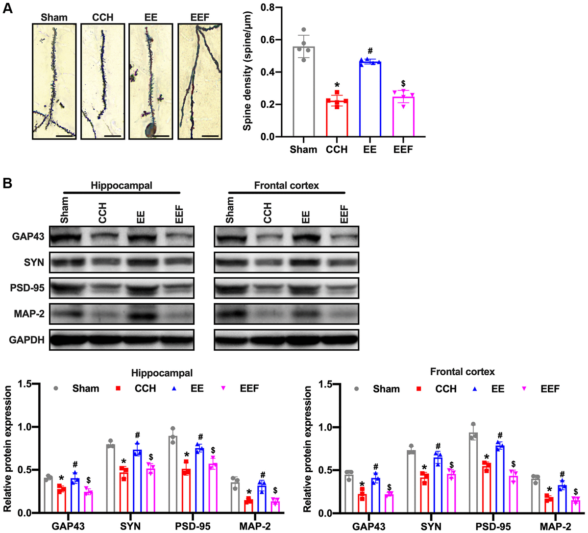EE improves synaptic morphology in CCH rats. (A) Neuronal spine density changes were detected by Golgi staining in the hippocampal in each group. Western blot were used to detect the expression of synaptic plasticity associated proteins. Number and length of dendritic spines. N = 5. (B) Levels of GAP43, SYN, PSD-95, MAP-2. *p #p $p N = 3. Sham group, treated with an equal volume of vehicle; CCH group, chronic cerebral hypoperfusion and no treatment; EE group, CCH and treated with EE. EEF group, CCH and treated with EE and FSH. *p #p $p 