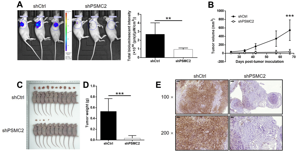 PSMC2 knockdown inhibited CCA development in vivo. (A) In vivo imaging was performed to evaluate the tumor burden in mice of shPSMC2 and shCtrl groups at day 67 post tumor-inoculation. The bioluminescence intensity was scanned and used as a representation of tumor burden in mice of shPSMC2 and shCtrl groups. (B) 24 days post injection of HCCC-9810 cells with or without PSMC2 knockdown, the volume of tumors formed in mice was measured and calculated at indicated time intervals. (C, D) Mice were sacrificed at day 67 post injection, and the tumors were removed for collecting photos (C) and weighing (D). (E) After removing the tumors, the Ki67 index was evaluated by IHC staining as a representative of tumor growth activity (scale bar = 100 μm in 100 magnification, scale bar = 50 μm in 200 magnification). Data was shown as mean ± SD. *P P P 