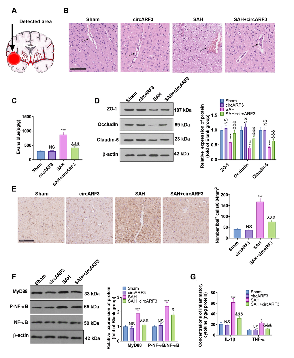 Overexpressing circARF3 alleviated SAH-induced BBB injury and MyD88-NF-κB pathway-mediated inflammation. (A) The ipsilateral basal cortex was used for histopathological examination. (B, C) The integrity of BBB was detected by HE staining and Evans blue staining. (D) The expression of ZO-1, Occludin, and Claudin-5 in BMECs was examined by WB. (E) IHC was applied to verify microglial/macrophages activation (labeled by Iba1). (F) The MyD88-NF-êB pathway activation was examined by WB. (G) The expression of IL-1â and TNF-á in the brain lesions was monitored by ELISA. NS, *, ***P>0. 05, P