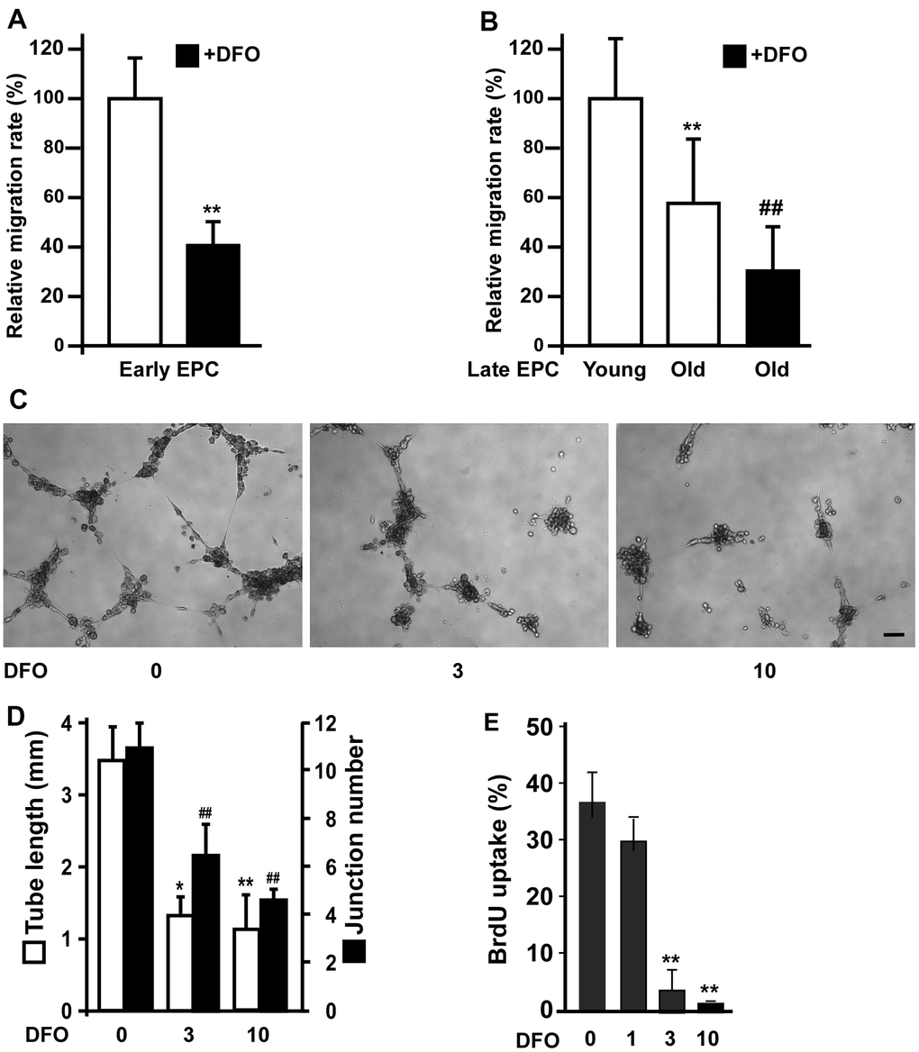 DFO impairs EPC angiogenic activity. (A) Early EPCs isolated from rat peripheral blood samples were treated with DFO (DFO, 3 μM) for four days, and then were subjected to migration assays. ** P B) Migration activity was reduced in old EPCs and further attenuated by DFO treatment. Human EPCs of the same clone with 10 additional passages were defined as old EPCs, as previously described [15]. Cells were treated with or without DFO (3 μM) for four days, and then were subjected to migration assays. ** P C) Late EPCs (1 × 104) were incubated with the indicated concentration of DFO for four days, and were harvested for tube formation assays by being seeded in matrix gel overnight. (D) Quantification of the tube length and junction number. The experiment was repeated with five different clones of EPCs with similar results. * P E) EPCs were treated with the indicated concentration of DFO for four days, and then were subjected to a BrdU incorporation assay. ** P 