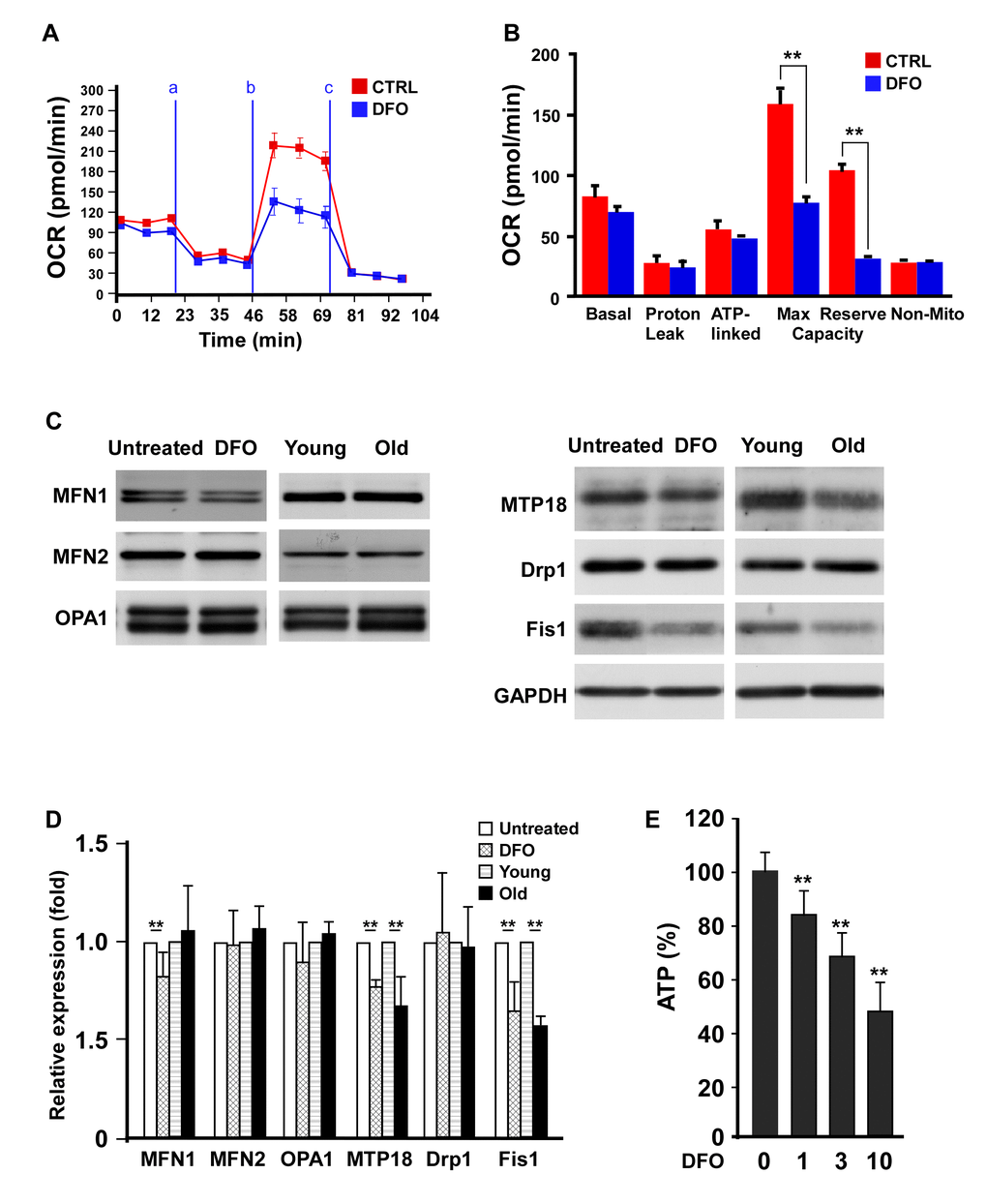 Deferoxamine alters EPC mitochondrial bioenergetics and dynamics. (A) DFO altered the bioenergetic profiles of human EPCs. Representative OCR curves of the EPCs are shown after the sequential addition of mitochondrial inhibitors to acquire respiratory parameters. The OCRs were automatically calculated and recorded in real time using Seahorse XF-24 software. EPCs with or without four-day 3 μM DFO treatment were seeded in a non-CO2 incubator for one hour before the OCR assay. Respiratory inhibitors were injected at the indicated times (a, oligomycin; b, CCCP; c, antimycin A) to determine the proton leak respiration, maximal respiratory capacity and mitochondrial reserve capacity, respectively. (B) Quantitative comparison of the OCRs of EPCs in the control (CTRL, 0 μM) and DFO (3 μM) groups. Despite proton leak respiration and non-mitochondrial respiration, all the OCR parameters were significantly reduced in the DFO group. * P C) Western blots were mitochondrial proteins in EPCs with or without DFO treatment, and in young or old EPCs. (D) Quantification of Western blot images are from three independent experiments. Young EPCs were treated with DFO (3 μM) for four days. EPCs of the same clone as the young EPCs with 10 additional passages were defined as old EPCs. (E) ATP production rate in DFO-treated EPCs. ** P 