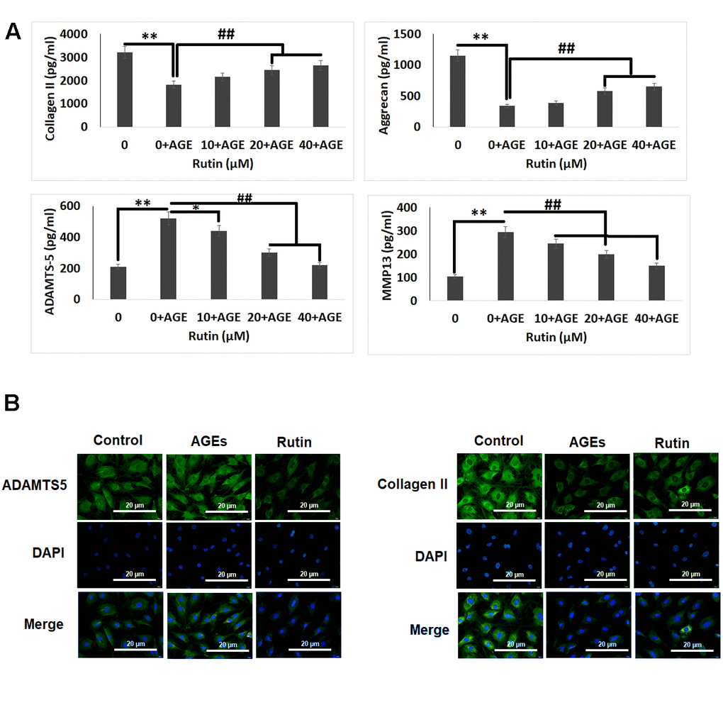 Effect of Rutin on AGE-induced ECM degradation in chondrocytes. (A) ELISA analysis for effect of Rutin treatment on levels of Collagen II, Aggrecan, ADAMTS-5 and MMP13. (B) Immunofluorescence along with DAPI staining analysis for detection of ADAMTS-5 and collagen II in chondrocytes. The results were mean ± SD. **P