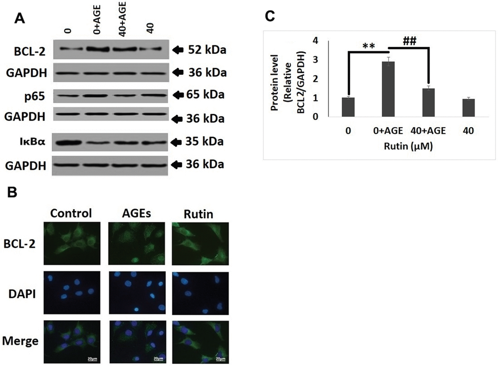 Rutin suppresses AGE mediated induction on the NF-κB pathway proteins. (A) Western blot analysis for expression of NF-κB pathway proteins BCL-2, p65 and IκBα in nuclei of AGEs chondrocytes treated with Rutin. (B) Immunofluorescence along with DAPI staining for studying the nuclei translocation of BCL-2. (C) Relative protein levels of BCL-2 in AGEs-induced chondrocytes treated with Rutin. The results were mean ± SD. **P