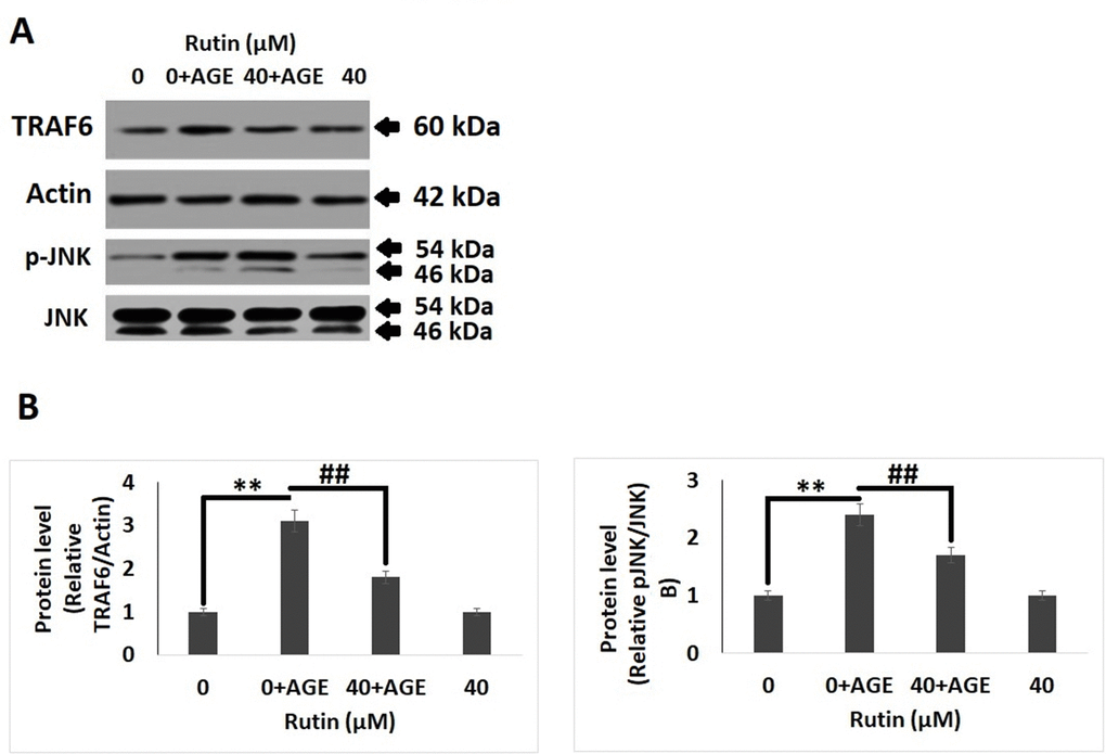 Rutin inhibits AGE-induced MAPK pathway proteins in chondrocytes. (A) Western blot analysis showing protein expression of TRAF6 and p-JNK. (B) Quantitative results showing relative expression of TRAF6 and JNK. The results were mean ± SD. **P