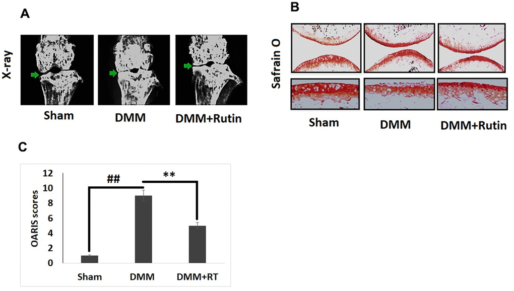 Rutin ameliorates the development of OA in DMM mice. (A) X-ray analysis showing knee of mice under various treatment groups. The OA mice showed narrowing of joint space and calcification of cartilage, however treatment of Rutin improved the joint space and also reduced the cartilage calcification. (B) S-O staining analysis of cartilage tissues in various treatment groups. (C) OARIS scoring of cartilage tissues of various treatment groups. The results are mean ± SD. ##P