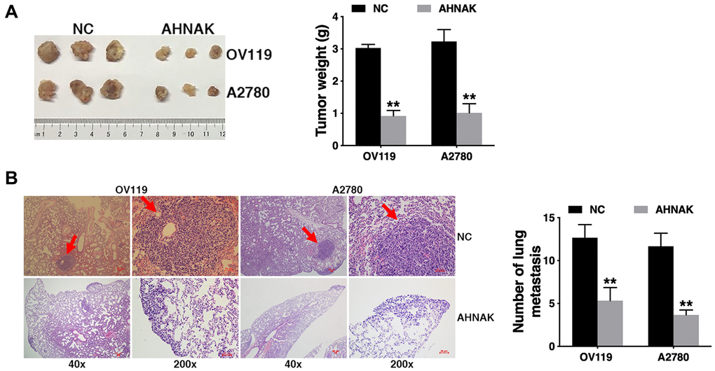 Elevated AHNAK content suppresses ovarian cancer tumor growth along with migration in vivo. (A) The tumors from the mouse xenograft model (n = 3 per group) are shown (left). The weights of the tumors are summarized (right). (B) HE-stained sections derived from lung metastatic nodules of the mouse xenograft model (n = 3 per group) are illustrated (left). The number of lung nodules was quantified (right). Original magnification: 40X and 200X, **P 