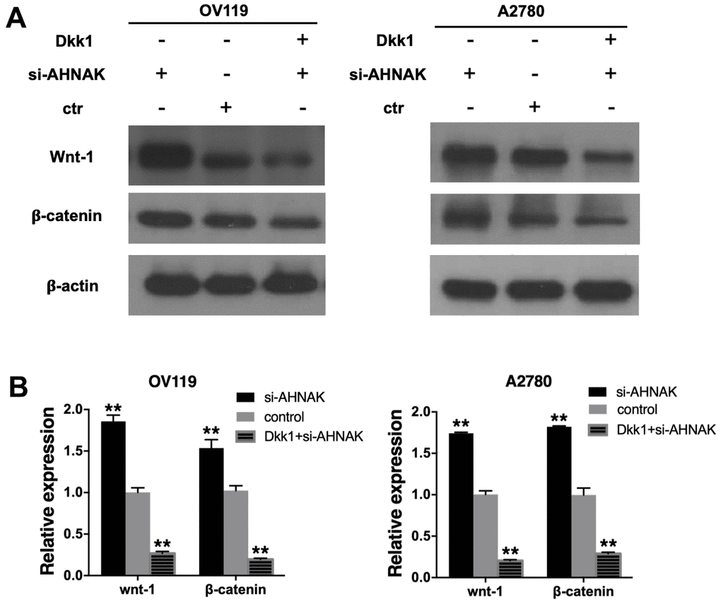 AHNAK represses ovarian cancer progress by targeting the Wnt/β-catenin cascade. (A) Western blotting evaluation of the contents of Canonical Wnt cascade markers. The Western blotting image in the right panel exhibits that the Wnt inhibitor, DKK1, suppressed Wnt signaling of AHNAK-siRNA activated signal in OV119 and A2780 cells. (B) qRT-PCR assays of the contents of Canonical Wnt cascade markers. Data are presented as the mean ± SD for n=3, **p 