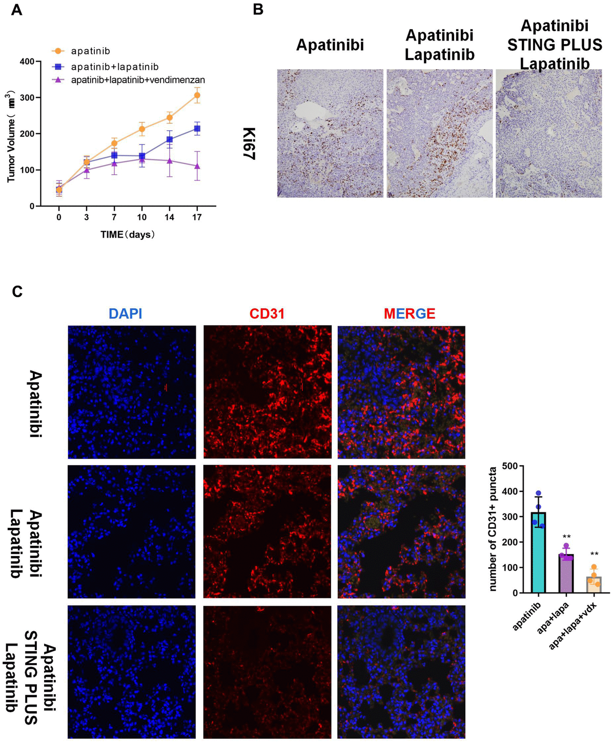 The combination of vadimenzan and lapatinib re-sensitizes AR cells to apatinib in vivo. (A) After washing with PBS three times, AR cells (total of 1 × 106) suspended in 50 μL of DMEM were injected in each injection site. The tumor volumes of the mice were evaluated among the three groups. (B) Ki67 staining images of cancer samples in the different groups. (C) Representative images of subcutaneous tumors using immunofluorescence staining against CD31 and DAPI nuclear staining. *P 