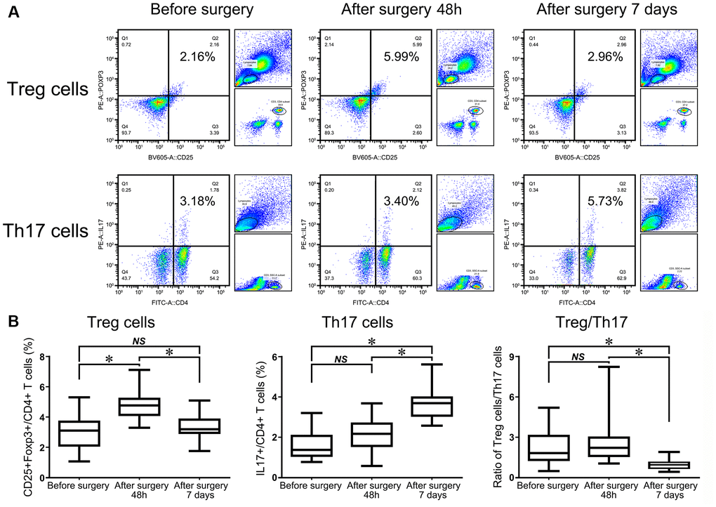 Flow cytometry analysis of CD4+CD25+Foxp3+ Tregs and CD4+IL17+ T cells in HF patients before surgery, 48 h after surgery, and 7 d after surgery (A). The statistical histogram shows the changes in Tregs, Th17+ cells and the ratio of Treg/Th17 cells in HF patients at the three different time points (B).