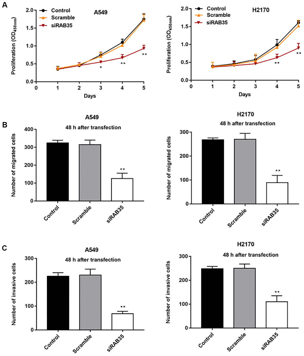 Knockdown of RAB35 inhibits proliferation, migration and invasion of NSCLC cells. RAB35 siRNA and negative control (Scramble) were transfected into A549 cells and H2170 cells, respectively. (A) CCK-8 assay was used to measure the proliferation of A549 and H2170 cells at day 1, 2, 3, 4, 5 after transfection, and the results showed that RAB35 knockdown inhibited cell proliferation. (B) The migration of A549 and H2170 cells was detected by Transwell cell migration assay, and the results showed that RAB35 knockdown inhibited cell migration. (C) The invasion of A549 and H2170 cells was analyzed by Transwell cell invasion assay, and the results showed that RAB35 knockdown inhibited cell invasion. β-actin was used as the loading control. N=6, ** P