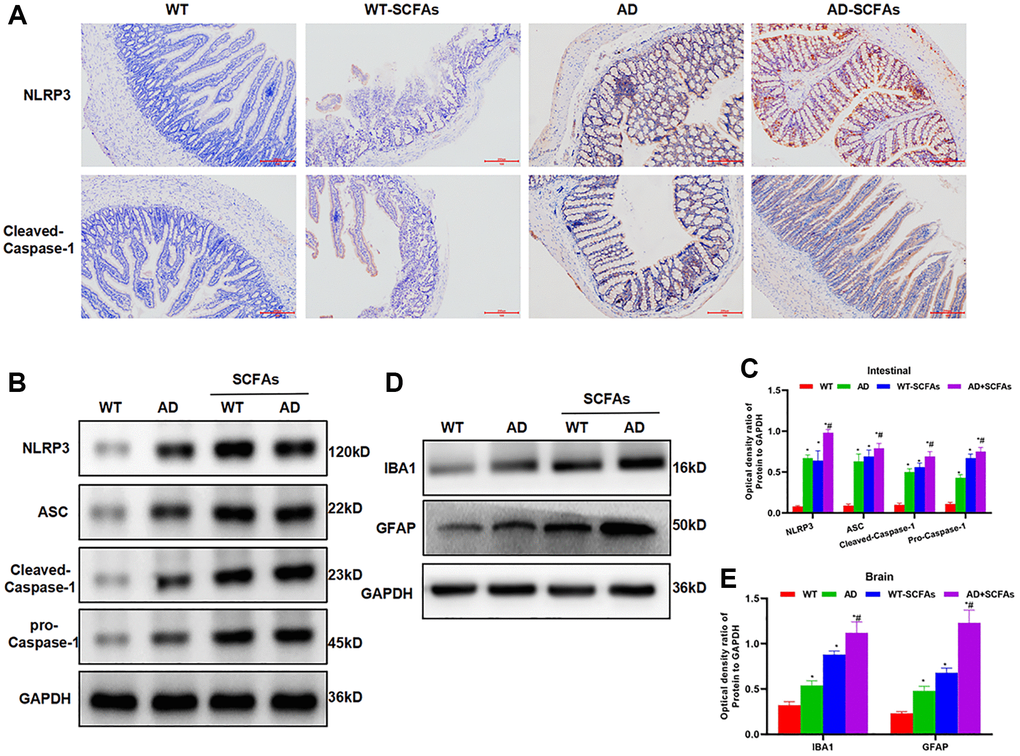Effect of SCFAs on the activation of intestinal NLRP3 inflammasome. (A) Detection of mouse intestinal NLRP3 and Caspase-1 expression by IHC (n = 5): The expression of NLRP3 and Caspase-1 was negative in the WT group and weakly positive in the WT-SCFAs group. SCFAs promoted the activation of NLRP3. The expression of NLRP3 and Caspase-1 was weakly positive in the AD group, and was positive in the AD-SCFAs group, which was significantly higher than that in the AD group. (B–C) The expression of NLRP3 inflammasome-related protein in the intestine (x¯ ± s, n = 10): The expression of NLRP3, cleaved-Caspase-1, ASC and Pro-Caspase-1 in the NLRP3 inflammasome was low in the WT group. Comparison with the WT group, *P #P D–E) The protein expression of microglia activation marker (IBA-1 and GFAP) in brain tissue (x¯ ± s, n = 10): Comparison with the WT group, *P #P 