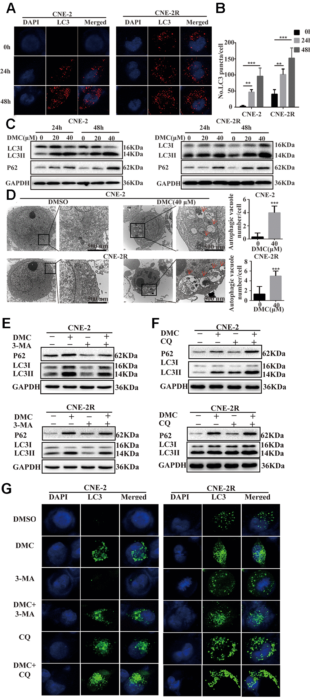 DMC increased the marker proteins of autophagy and autophagosomes in NPC cells. (A) Representative images of LC3-labelled red fluorescence puncta after 20 μM DMC for 0, 24, 48 h in CNE-2 and CNE-2R cells. Scale bars: 10 μm. (B) Statistical analysis histogram of LC3-labeled red fluorescence puncta in per cell and over 30 cells were counted in each group. (n = 3; **p ***p C) Western blotting analysis of LC3-I, LC3-II and P62 levels in CNE-2 and CNE-2R cells treated with the indicated concentrations of DMC for 24 h and 48 h. GAPDH was used as a loading control. (D) Transmission electron microscopy images in CNE-2 and CNE-2R cells after treating with control or DMC (40 μM) for 24 h. Red arrows: autophagosomes. Scale bars: 500 nm. (E, F) Western blotting analysis of LC3-I, LC3-II and P62 levels in CNE-2 and CNE-2R cells after treating with 0.1% DMSO or 20 μM DMC in the absence or presence of 3-MA (5 mM) and CQ (20 μM) for 24 h. GAPDH was used as a loading control. (G) Representative images of LC3-labelled green fluorescence puncta after treating with 0.1% DMSO or 20 μM DMC in the absence or presence of 3-MA (5 mM) and CQ (20 μM) for 24 h in CNE-2 and CNE-2R cells. Scale bars: 10 μm.