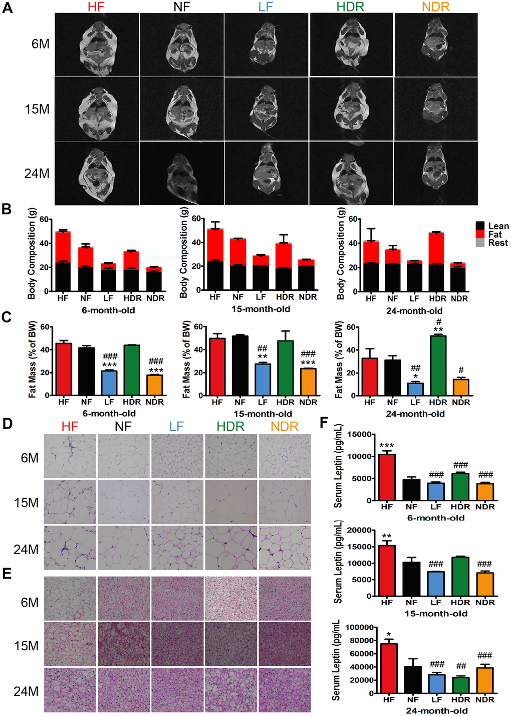 Effects of calories and food quantity on the lifespan and energy state. (A) T1-weighted MRI images of mice, where the highlighted part represents body fat. (B) Body composition of mice in each dietary group at different ages, and the corresponding (C) fat mass as a percentage of total body weight. Representative H&E-stained histological sections of (D) eWAT and (E) BAT under the different feeding conditions, as indicated. (F) Serum leptin concentration (n=6 per group). Data are presented as mean±SEM, #P##P###P*P**P***P