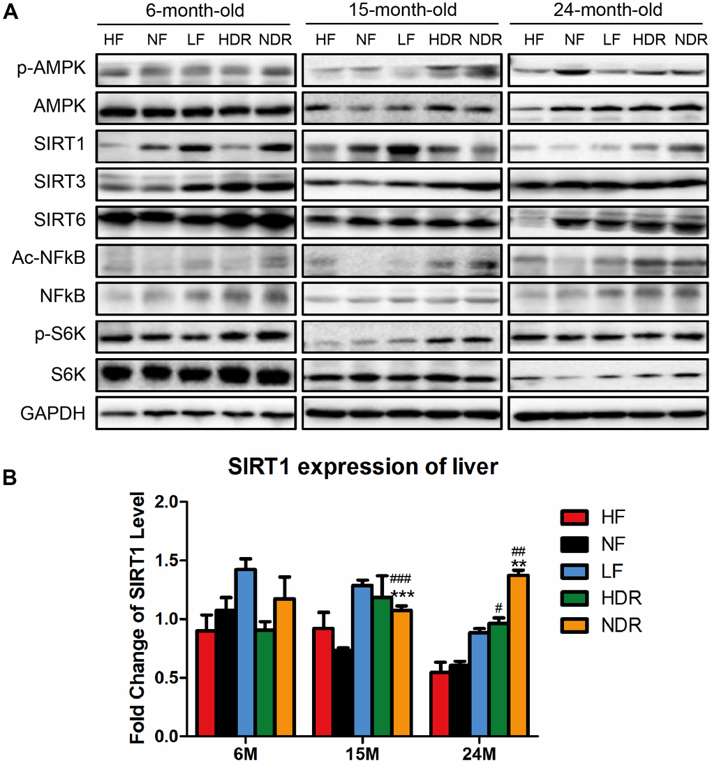 Quantitative analysis of the expression of proteins related to classic pathways of calorie restriction. (A) Western blotting analysis of SIRT1, SIRT3, SIRT6, phospho-AMPK, Ac-NFĸB in the liver of mice from different experimental groups (n=3 per group). (B) Immunohistochemical analysis of SIRT1 and Ac-NFĸB expression in the liver. #P##P###P*P**P***P