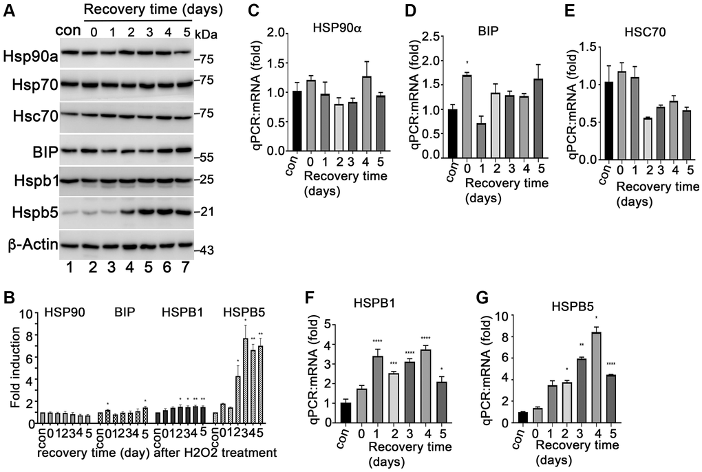 Expression of heat shock proteins during ARPE-19 senescence. (A) Immunoblot of HSP90α, HSP70, HSC70, BIP, HSPB1 (HSP27), HSPB5 (αB-crystallin) and β-actin in ARPE-19 cells treated with H2O2 in the same way as Figure 1B. (B) Densitometry quantitation of protein bands in A in image J. The data shown are mean ± SD. The two-tailed unpaired t-test was used for statistical analysis (n = 3). (C–G) Quantitative PCR to measure the expression of HSP90α, BIP, HSC70, HSPB1 and HSPB5 in the cells treated with H2O2 the same way as A. The data were from three independent experiments. The two-tailed unpaired t-test was used for statistical analysis (n = 3).
