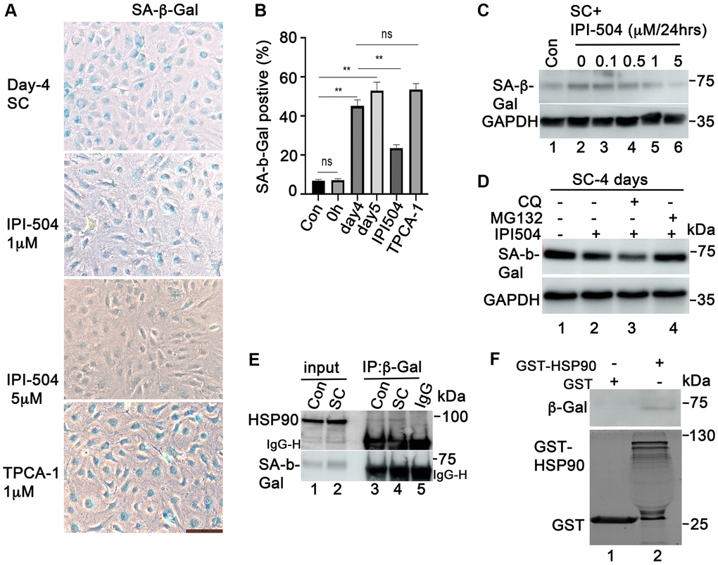 HSP90 associates with and regulates SA-β-Gal in senescent ARPE-19 cells in vitro. (A) SA-β-Gal staining the passage 3 primary monkey RPE cells treated with H2O2 for 2 h followed by recovery in normal media for 5 days. IPI-504 (1 and 5 μM) or TPCA-1 (1 μM) were added to day 4 recovery cells for 24 hours. (B) Percentage of SA-β-Gal positive cells out of total number of cells in A. Numbers were derived as an average from 5 different fields of view from three independent experiments. (C) Immunoblot of SA-μ-Gal protein in proliferating ARPE-19 cells (Con, lane 1) or the senescent ARPE-19 cells treated with IPI-504 at 0, 0.1, 0.5, 1 and 5 μM for 24 hours. (D) MG132 rescued the down-regulation of SA-β-Gal protein by IPI-504 in senescent ARPE-19 cells. (E) Immunoprecipitation assay to determine the interaction between HSP90 and SA-β-Gal protein in control (lane 3) and senescent ARPE-19 cells (lane 4). Lanes 1–2 are cell lysate controls, lane 5 is IgG control. (F) GST-pull down assay to determine the interaction between SA-β-Gal proteins and bacterially purified GST-HSP90 in senescent ARPE-19 cells. Upper panel shows the SA-β-Gal protein in day 4 senescent ARPE-19 cells that co-precipitated with bacterially expressed GST-HSP90α fusion protein (lane 2) or GST protein alone (lane 1). The lower panel is the coomassie blue stain of the bacterially purified GST and GST-HSP 90α.