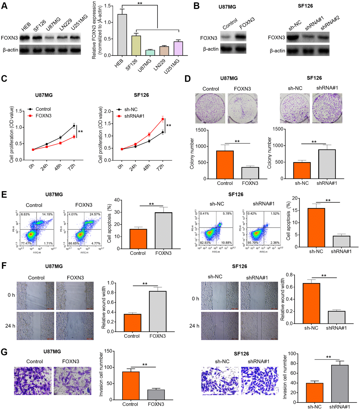 FOXN3 suppresses glioma cell proliferation, survival and invasion. (A) FOXN3 protein expression levels in normal human L02 liver cells and glioma cell lines (SF126, SK-Hep-1, Huh6 and Huh7) were determined by Western blotting. (B) Transfection efficiency was detected via Western blotting after transfection with FOXN3 expression vectors in U87MG cells or transfection with specific shRNAs in SF126 cells. (C) Cell proliferation was measured by MTT assays after transfection with FOXN3 expression vectors in U87MG cells or transfection with shRNA#1 in SF126 cells. (D) Colony formation ability was analyzed using colony formation assays after transfection with FOXN3 expression vectors in U87MG cells or transfection with shRNA#1 in SF126 cells. (E) Apoptosis was assessed via flow cytometry after transfection with FOXN3 expression vectors in U87MG cells or transfection with shRNA#1 in SF126 cells. (F) Migration capability was evaluated by scratch wound healing assays after transfection with FOXN3 expression vectors in U87MG cells or transfection with shRNA#1 in SF126 cells. (G) Invasion ability was determined via Transwell invasion assays after transfection with FOXN3 expression vectors in U87MG cells or transfection with shRNA#1 in SF126 cells. **P 