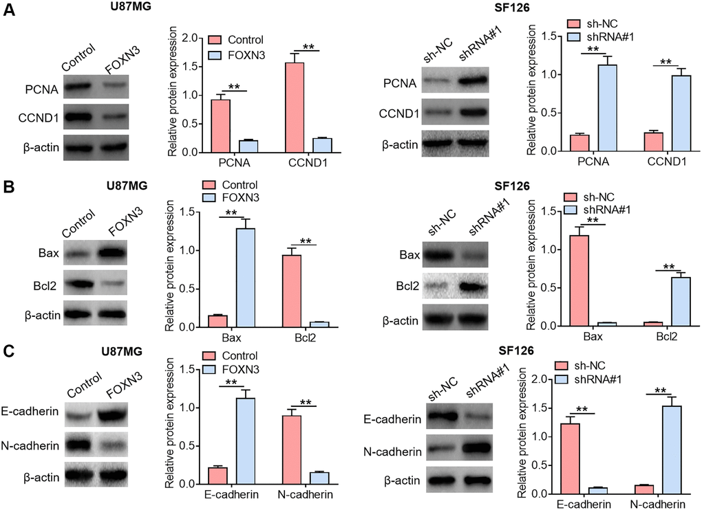 FOXN3 modulates the expression of malignant phenotype-associated proteins in glioma cells. (A) Protein expression levels of PCNA and CCND1 were examined by Western blotting after transfection with FOXN3 expression vectors in U87MG cells or transfection with shRNA#1 in SF126 cells. (B) Protein expression levels of cleaved caspase 3 and Bcl2 were detected via Western blotting after transfection with FOXN3 expression vectors in U87MG cells or transfection with shRNA#1 in SF126 cells. (C) Protein expression levels of Vimentin and MMP9 were determined using Western blotting after transfection with FOXN3 expression vectors in U87MG cells or transfection with shRNA#1 in SF126 cells. **P 