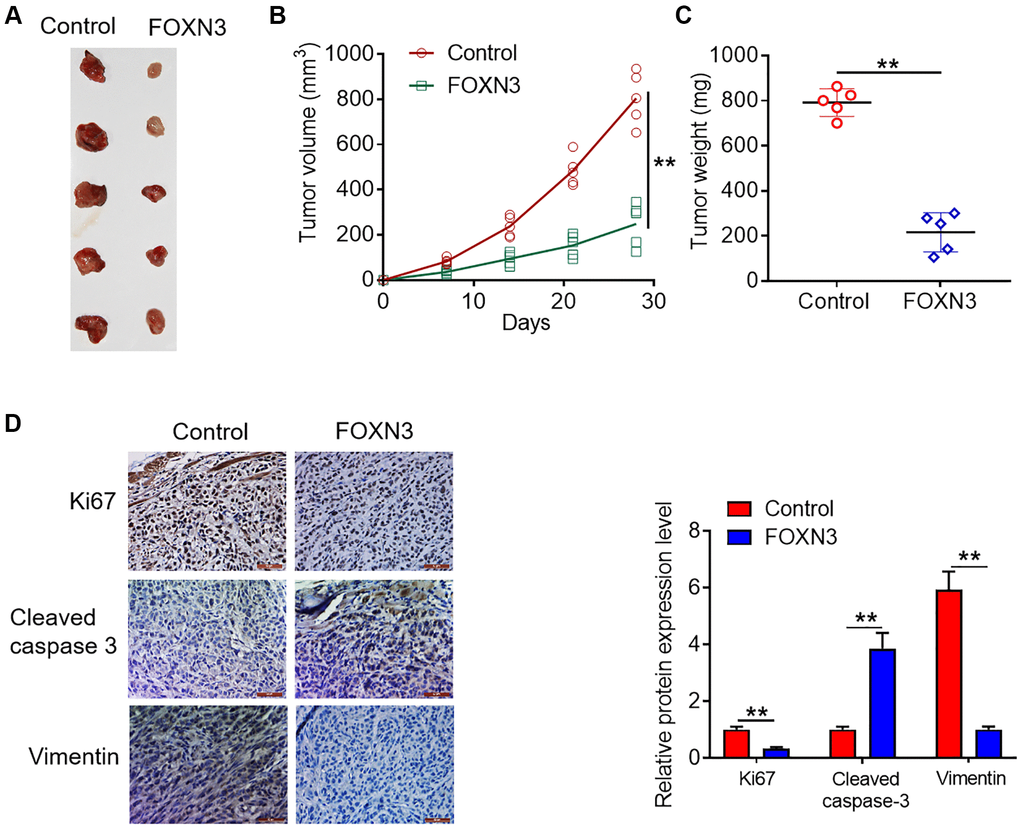 FOXN3 over-expression retards glioma cell growth in vivo. (A) Representative images of tumors harvested from murine neoplasm xenograft models. (B) Tumor growth curve was plotted based on the formula that volume (mm3) = [length (mm) × width2 (mm2)]/2. (C) Neoplasms were collected and weighed at day 28 post-transplantation. (D) Protein expression patterns of Ki67, cleaved caspase 3 and Vimentin in the tumors harvested from nude mice were visualized via immunohistochemical staining. **P 