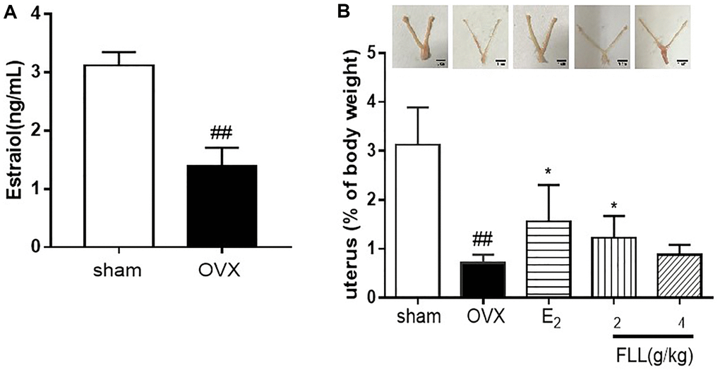 FLL suppresses uterine atrophy induced by OVX. (A) Estradiol concentrations were significantly diminished one week after OVX in all mice as detected by ELISA kit. (B) Uterine atrophy in OVX mice after treatment with FLL at 8 weeks. ##P *P n = 10).