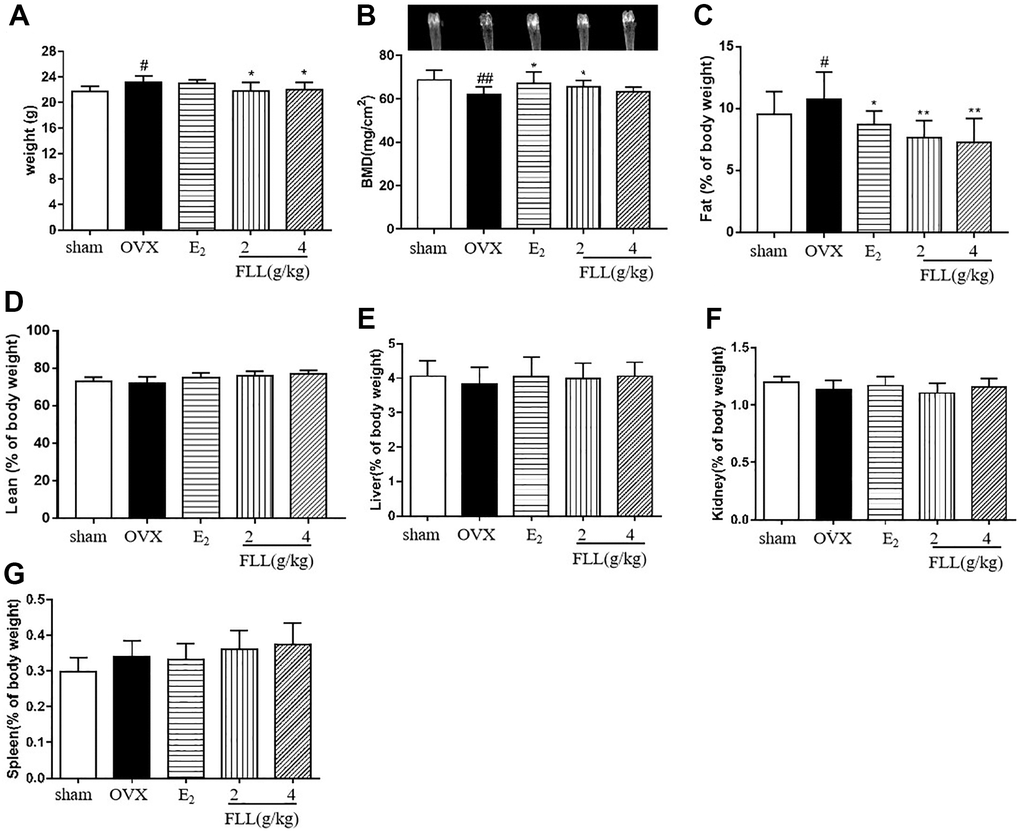 FLL suppresses bone loss and reduces fat weight in OVX mice. (A) Body weights of OVX mice 8 weeks post-operatively. Treatment with FLL decreased body weight significantly. (B) Bone mineral density (BMD) in the femurs of OVX mice decreased significantly compared to the sham group, and estrogen and FLL significantly augmented BMD in OVX mice. The body fat and (C) lean content (D) of each group were evaluated by NMR body composition analyzer after 8 weeks. (E–G) The indices for liver, kidney and spleen among groups. #P ##P *P **P n = 10).