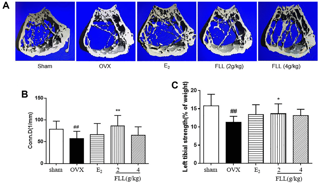 FLL improves bone microstructure and mechanical properties in OVX mice. (A) The microstructure of the distal femur by micro-CT showed that trabecular bone was severely reduced in the model group but recovered with estrogen and FLL treatment. Conn.D (bone trabecular connection density) (B) and left tibial strength (C) in the model group were significantly lower than in the sham group but recovered with 2g/kg of FLL. ##P *P **P n = 10).
