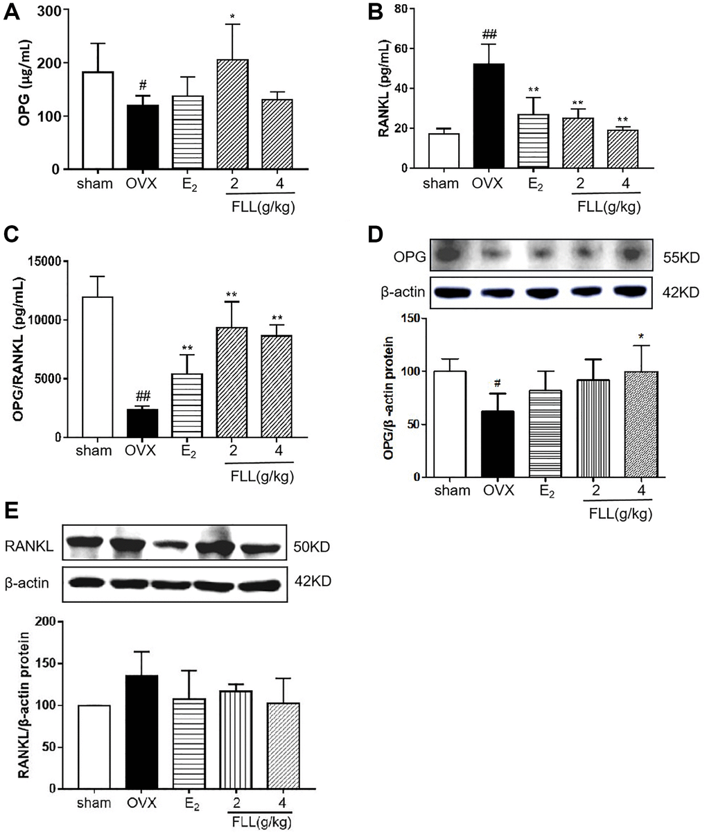 FLL promotes the expression of OPG and inhibits the expression of RANKL in OVX mice. Plasma levels of OPG (A) and RANKL (B) were measured by ELISA. The level of OPG significantly increased in the FLL group compared to the OVX group, and the level of RANKL was commensurately attenuated. (C) The ratio of OPG/RANKL was significantly reduced in the OVX group, while it significantly increased after treatment with FLL (n = 10). (D–E) FLL treatment promoted OPG and inhibited RANKL proteins in bone tissue. #P ##P *P **P n = 3).