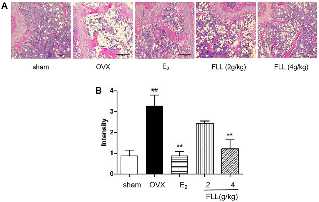 FLL reduces fat content in the bone marrow of OVX mice. (A) H&E staining showed that the white vacuoles in bone marrow increased in the OVX group, while estrogen and FLL significantly reduced the area of white vacuoles after eight weeks of treatment in OVX mice. (B) The white vacuoles were measured quantitatively and data are shown below. ##P **P n = 3).