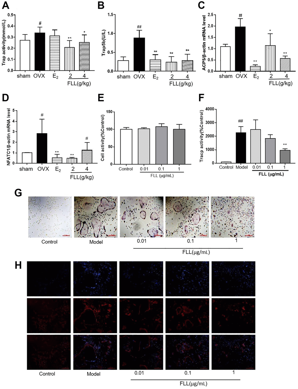 FLL inhibits osteoclastogenesis and function by downregulation of Trap activity and levels of Trap5b and NFATc1. (A–B) The levels of Trap activity and Trap-5b proteins in plasma markedly decreased after treatment with FLL (n = 10). (C–D) Trap mRNA expression in the OVX group was significantly higher than in the sham group. Estrogen and FLL suppressed the increase in ACP5 and NFATc1 mRNA expression. (n = 3). (E) Monocytes from bone marrow were cultured with M-CSF (2.5 μg/mL) and FLL seven days before being subjected to CCK-8 assay. (F) The monocytes were treated with M-CSF (2.5 μg/mL) and RANKL (5 μg/mL) for 7 days and assessed by tartrate-resistant acid phosphatase (Tracp). FLL (1 μg/mL) significantly suppressed Tracp activity. (n = 6). (G–H) Monocytes were treated with M-CSF (2.5 μg/mL) and RANKL (5 μg/mL) for 7 days and stained for Tracp and F-actin rings. #P ##P *P **P n = 3).