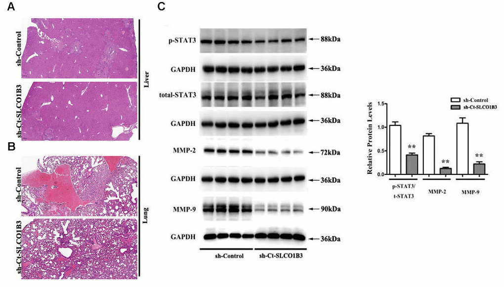 The effects of Ct-SLCO1B3 knockdown on CRC metastasis in vivo. (A, B) H&E staining of the liver and lung tissues showing metastatic nodules. (C) The expression of p-STAT3, STAT3, MMP-2, and MMP-9 in metastatic tumors by western blot analysis. **P 