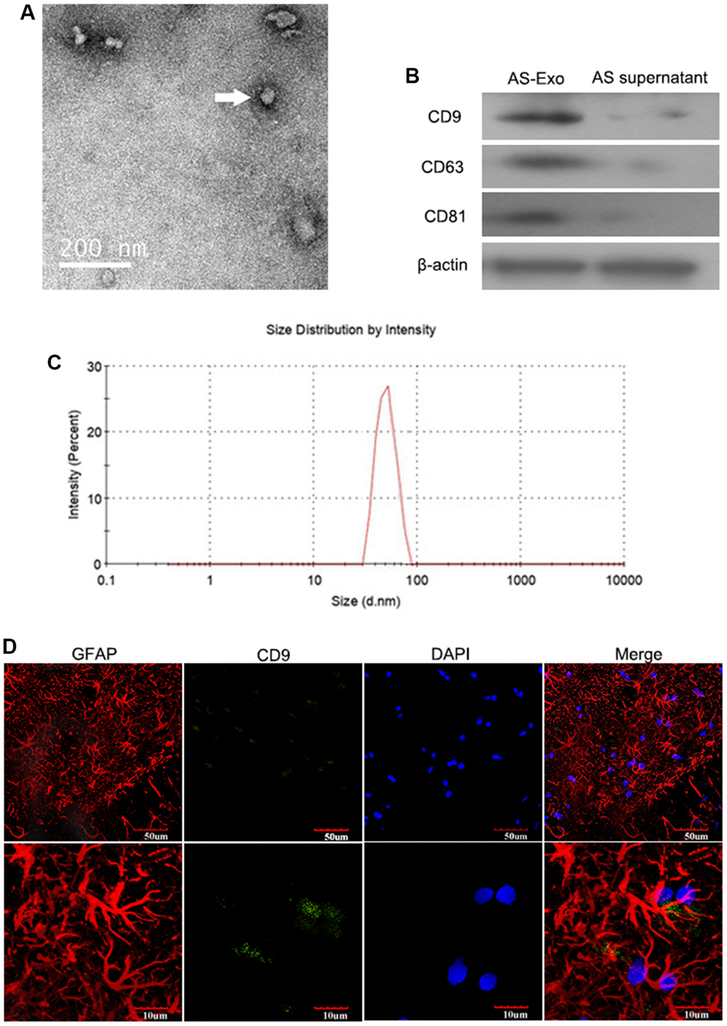 Characterization of AS-Exosomes. (A) Representative transmission electron microscopy (TEM) image show exosomes generated by primary astrocytes. (B) Western blot analysis shows expression levels of exosomal biomarkers such as CD9, CD63, CD81, HSP90B1, and GM130 in astrocyte-derived exosomes (AS-Exo) and astrocyte supernatant. (C) Particle size analysis of AS-Exo. (D) The identification of astrocytes and AS-Exo.