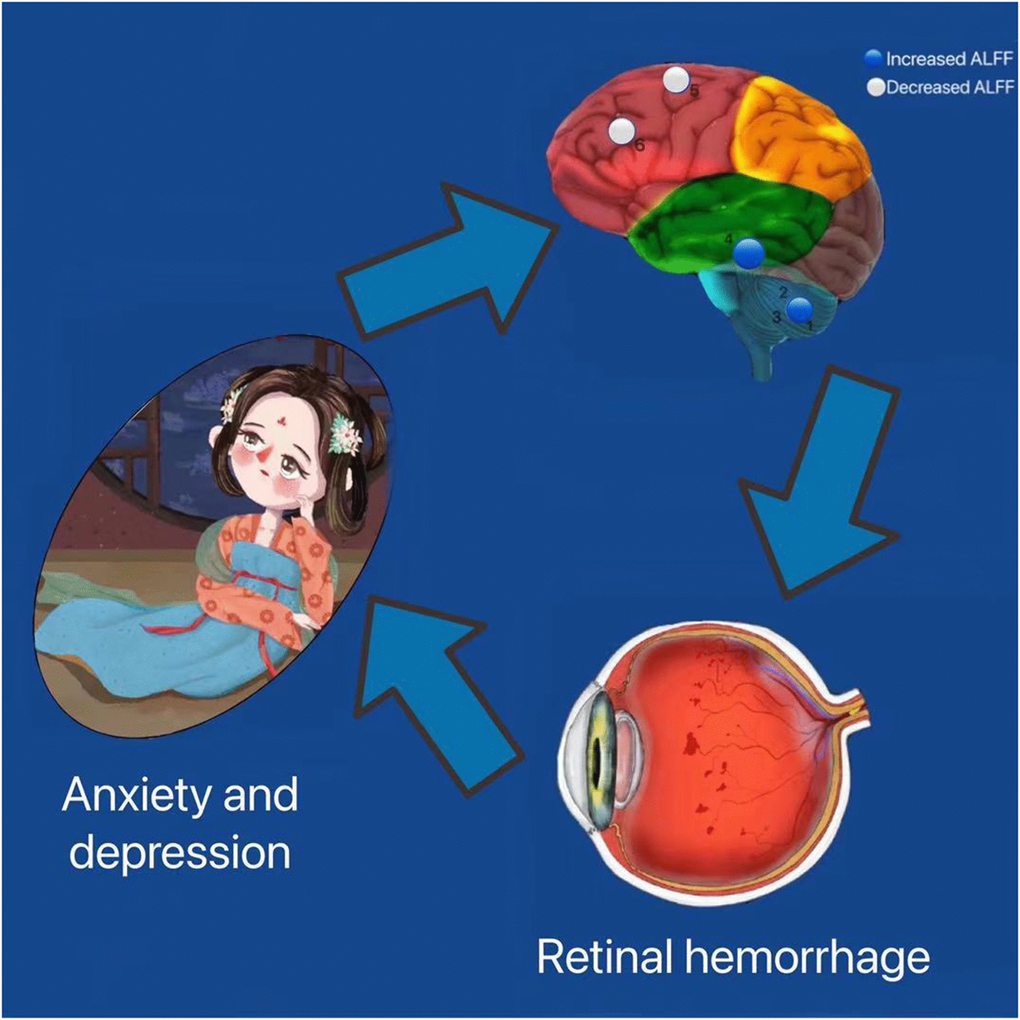 Correlation between functional MRI and clinical manifestation and psychological emotion of HR patients. The ALFF values of the medial LSFG and the LMFG in patients with HR were decreased. HR patients performed more anxiety and depression. Abbreviations: HR: hypertensive retinopathy.