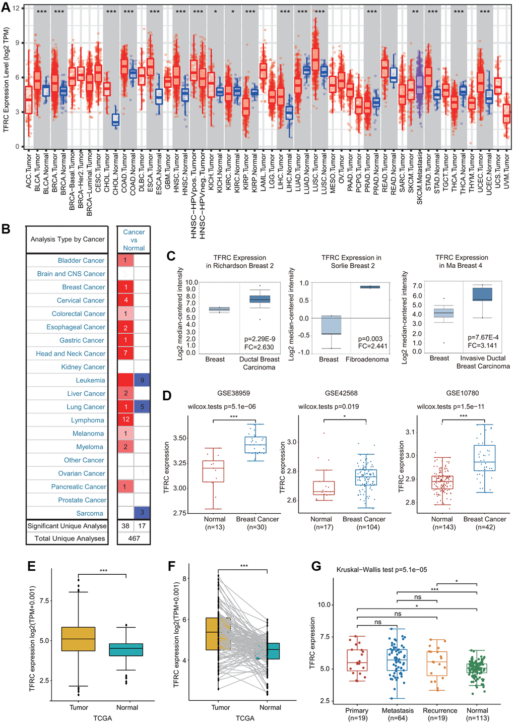 Expression of TfR1 in BC. (A) The expression of TfR1 in various cancers from the TIMER database. (B) The change in TfR1 expression in common cancers was obtained using the Oncomine database. (C) TfR1 is overexpressed in BC tissues in the Oncomine database. (D) TfR1 was overexpressed in BC tissues (GSE38959, n = 30; GSE42568, n = 104; GSE10780, n = 42) compared with adjacent normal tissues (GSE38959, n = 13; GSE42568, n = 17; GSE10780, n = 143) in the different GEO datasets. (E) TfR1 expression is elevated in BC tissues compared with noncancerous adjacent tissues from the TCGA database. (F) TfR1 expression in 112 matched BC tissues and adjacent normal tissues in the TCGA database was investigated. (G) TfR1 expression in primary cancer, metastasis and recurrence in BC patients. ******