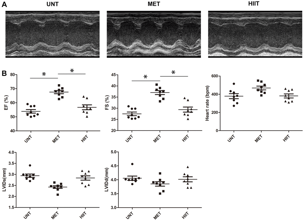 MET improves myocardial function in aging mice. (A) Representative M-mode echocardiogram. (B) LV ejection fraction (EF), LV fraction shortening (FS), LV internal dimension end-systolic (LVIDs), LV internal dimension end-diastolic (LVIDd), and heart rate were evaluated via echocardiography. n = 8 mice from each group, *P 