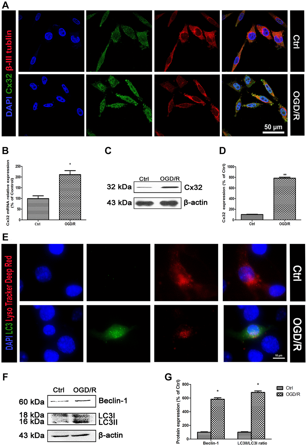 OGD/R induced up-regulation of Cx32 expression and activation of autophagy. (A) Double labeling of Cx32 and β-tubulin in the Ctrl or OGD/R (2h OGD following 24 h recovery) group. Scale bars, 50 μm. (B) The mRNA level of Cx32 was detected by qPCR. (C–D) Representative bands of Cx32 protein in the cells after OGD/R. (E) The autophagosome was labeled with LC3 (green), autophagolysosome was marked by LysoTracker probes (red), and cell nuclei were counterstained by DAPI (blue). Scale bars, 20 μm. (F–G) Representative bands of Beclin1 and LC3 protein in SH-SY5Y cells after OGD/R. Variation in protein loading was determined by blotting with an anti-β-actin antibody. Densitometric scanning of band intensities were calculated as means ± SD (n = 3). *p **p 