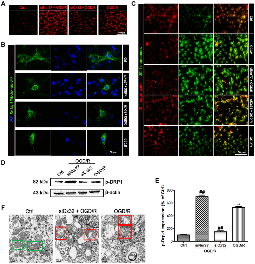 Nur77 attenuated mitochondrial dysfunction after the inhibition of Cx32 following OGD/R injury. Cells were transfected with Cx32 siRNA or Nur77 siRNA for 24 h followed by OGD/R (2 h OGD following by 24 h recovery) before harvested. (A) The level of ROS was detected by DCF-DA. Scale bars, 100 μm. (B) Mitochondria was labeled with GFP (green); cell nuclei were counterstained with DAPI (blue). Photomicrographs were captured under a Nikon Ni-U fluorescence microscope. Scale bars, 50 μm. (C) Δψm was detected by JC-1 dye. Images were shown as the ratio of JC-1 aggregates to JC-1 monomers. Scale bars, 50 μm. (D–E) Representative bands of p-Drp-1, COX4 and TOMM20 protein after OGD/R. Variation in protein loading was determined by blotting with an anti-β-actin antibody. Densitometric scanning of band intensities were calculated as means ± SD (n = 3). **p ##p F) Images were collected by transmission electron microscope. Green square represents normal mitochondria with cylindrical shape. Their cristae was well-defined, the double membranes was intact and the density was homogenous; Red square represents abnormal mitochondria. Their cristae was disordered, double membrane was discontinuous, electron density was decreased and minor axis was increased consistent with mitochondrial swelling. Scale bars, 0.5 μm.