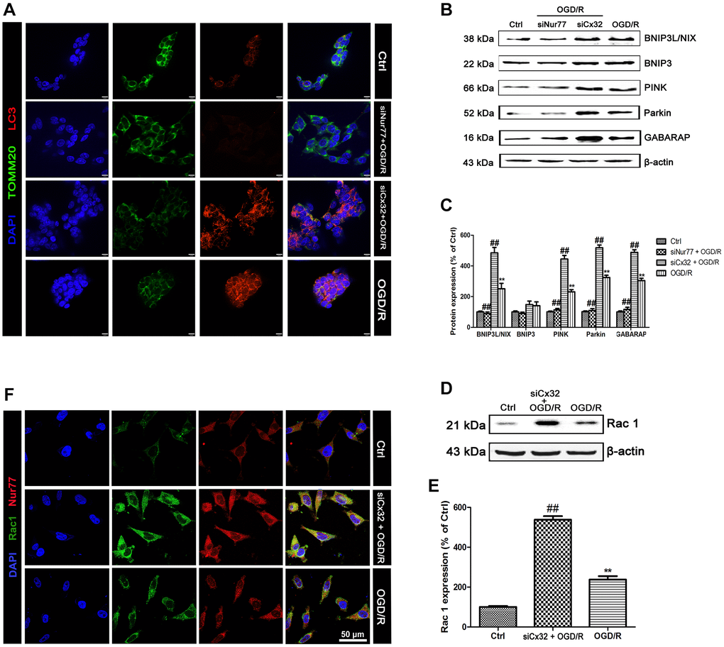 Nur77 activated mitophagy after the inhibition of Cx32 following OGD/R injury. Cells were transfected with Cx32 siRNA or Nur77 siRNA for 24 h followed by OGD/R (2 h OGD following by 24 h recovery) before harvested. (A) The autophagosome was marked with LC3 (red); mitochondria was marked by TOMM20 (green). Scale bars, 25 μm. (B–C) Representative bands of BNIP3L/NIX, BNIP3, PINK, Parkin, and GABARAP protein in the cells after OGD/R. (D–E) Representative bands of Rac1 protein after OGD/R. Variation in protein loading was determined by blotting with an anti-β-actin antibody. Densitometric scanning of band intensities were calculated as means ± SD (n = 3). **p ##p F) Double labeling of Nur77 and Rac1 using fixed cells of Control, OGD/R or siCx32 group. Scale bars, 50 μm.