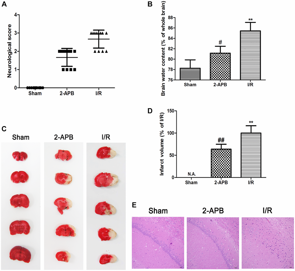 2-APB decreased neuronal damage after I/R injury. (A) Neurologic scores were evaluated at 72 h after reperfusion (n = 12). (B) Brain edema was examined at 72 h after reperfusion. Data are expressed as means ± SD (n = 6). (C–D) The infarct area was observed by TTC staining. The infarct size was shown as the ratio of corrected infarct area to whole brain area. Data are expressed as means ± SD (n = 6). **p ##p E) The brain sections of rats were stained with H&E staining (magnification, ×200).