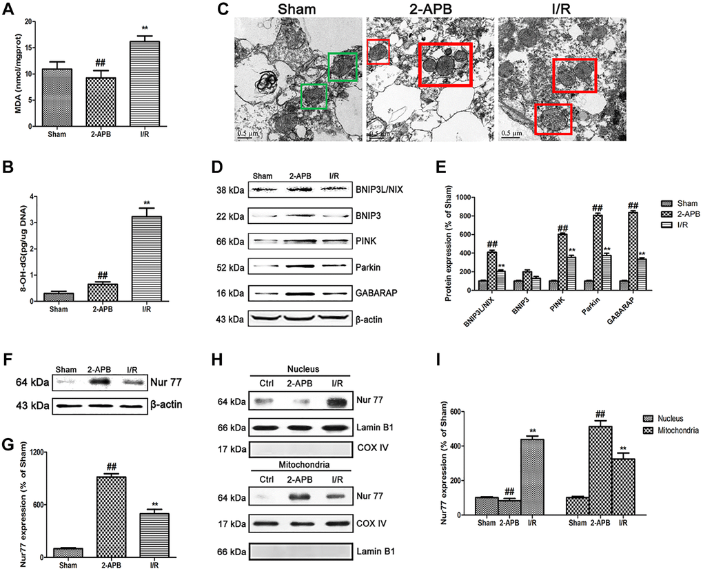 2-APB activated mitophagy through promoting Nur77 translocation from nucleus to mitochondrial after I/R injury. (A) and (B) The levels of MDA and 8-OH-dG were examined at 72 h after reperfusion. (C) Images acquired by transmission electron microscope. Green square represents normal mitochondria with cylindrical shape. Their cristae was well-defined, the double membranes was intact and the density was homogenous; Red square represents abnormal mitochondria. Their cristae was disordered, double membrane was discontinuous, electron density was decreased and minor axis was increased consistent with mitochondrial swelling. Scale bars, 0.5 μm. (D–E) Representative bands of mitophagy-related proteins in brain tissues after I/R. (F–G) Representative bands of Nur77 protein in brain tissues after I/R. (H–I) Mitochondrial translocation of Nur77 was examined by Western blot after I/R. Mitochondria Nur77 expression was normalized against COX IV. Nucleus Nur77 expression was normalized against Lamin B1 expression. Variation in protein loading was determined by blotting with an anti-β-actin antibody. Densitometric scanning of band intensities were calculated as means ± SD (n = 3). **p ##p 