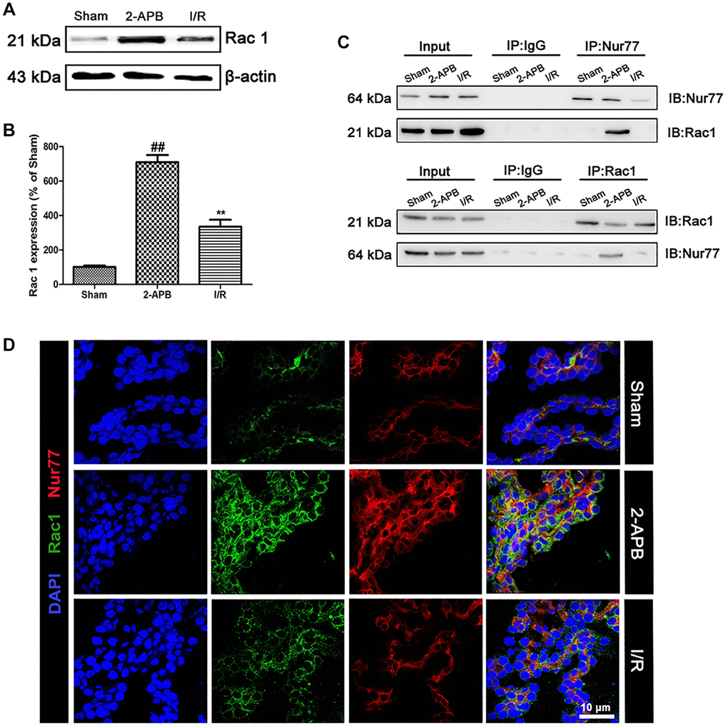 2-APB prohibited the dissociation of Rac1 and Nur77 after I/R injury. (A–B) Representative bands of Rac1 protein in brain tissues after I/R. Statistical results from the densitometric measurements after normalization against β-actin were calculated as means ± SD (n = 3). **p ##p C) Detect the correlation between Nur77 and Rac1 by a Co-IP assay. (D) Double labeling of Rac1 and Nur77 in the brain tissues of Sham or I/R group. Scale bars, 50 μm.