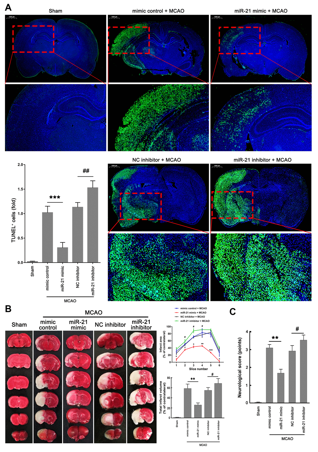 MiR-21/p53/Bcl-2/Bax signaling regulates ischemic neuronal injury in vivo. (A) Representative images showed the TUNEL-labeled cells in the brain slices. Bar graph summarized the numbers of TUNEL+ cells (fold) in the ischemic region. Scale bar, 1000μm. (B) Brain infarction was visualized by TTC staining at 24 h after operation. Curve lines summarized infarct areas in the ipsilateral hemisphere normalized to the total areas of the contralateral hemisphere in sequential coronal brain slices. Bar graph showed the volumes of total cerebral infarct in the ipsilateral hemisphere normalized to the total volumes of the contralateral hemisphere. (C) Neurologic deficits were analyzed by a neurologic deficit score. Eight mice were randomly selected from each treatment group. *, mimic control + MCAO group vs. miR-21 mimic + MCAO group. *P≤0.05, **P≤0.01, ***P≤0.001. #, NC inhibitor + MCAO group vs. miR-21 inhibitor + MCAO group. #P≤0.05, ##P≤0.01.