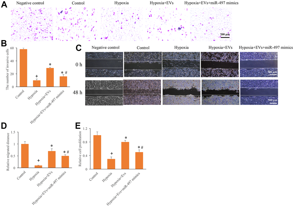 Overexpression of miR-497 reversed the promotion of cell migration, invasion, and proliferation caused by EVs. (A) Influence of EVs and miR-497 mimics on cell invasion; (B) The influence of EVs and miR-497 mimics on cell invasion was analyzed; (C) Influence of EVs and miR-497 mimics on cell migration; (D) The influence of EVs and miR-497 mimics on cell migration was analyzed; (E) I The influence of EVs and miR-497 mimics on cell proliferation was analyzed. + indicated P