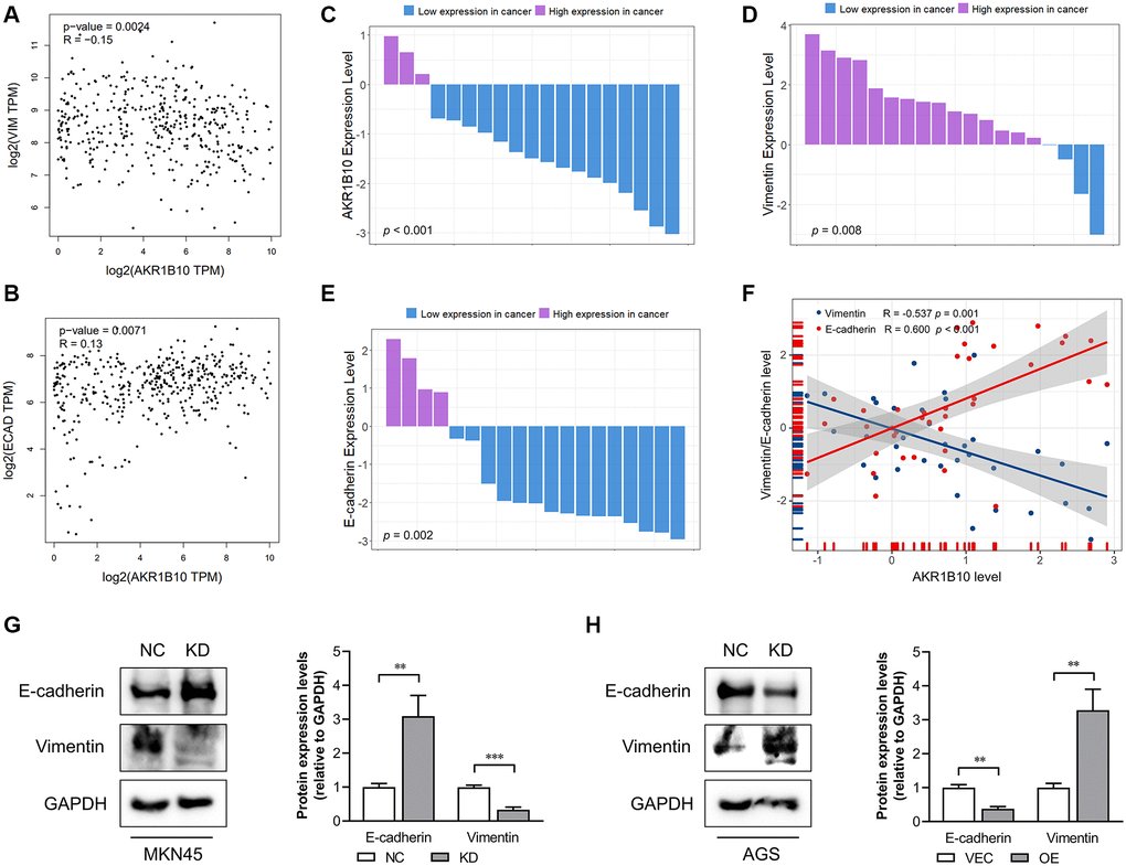 Correlation between AKR1B10 and epithelial-mesenchymal transition. (A) Correlation analysis of AKR1B10 and Vimentin gene expression levels in gastric cancer (GC) patients by the GEPIA platform. (B) Correlation analysis of AKR1B10 and E-cadherin gene expression levels in GC patients by the GEPIA platform. (C–E) Comparison of AKR1B10 (C), Vimentin (D) and E-cadherin (E) mRNA levels in 19 paired GC and normal tissues. (F) Correlation between AKR1B10 and Vimentin, and between AKR1B10 and E-cadherin mRNA levels in GC tissues. (G) MKN45 cells transfected with NC or KD and (H) AGS transfected with VEC or AKR1B10-OE. The bands were semi-quantified by ImageJ and the results are presented as the mean ± SD. VIM, Vimentin; ECAD, E-cadherin; TPM, transcripts per million. NC, negative control; KD, knockdown; VEC, vector; OE, overexpression. **P ***P 